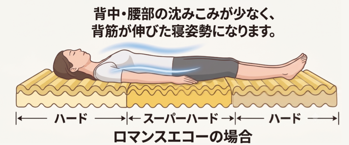 ロマンスエコーで寝た場合のイラスト